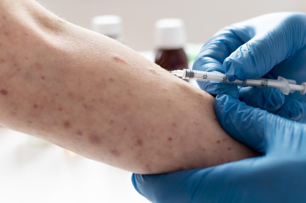 Measles cases in india