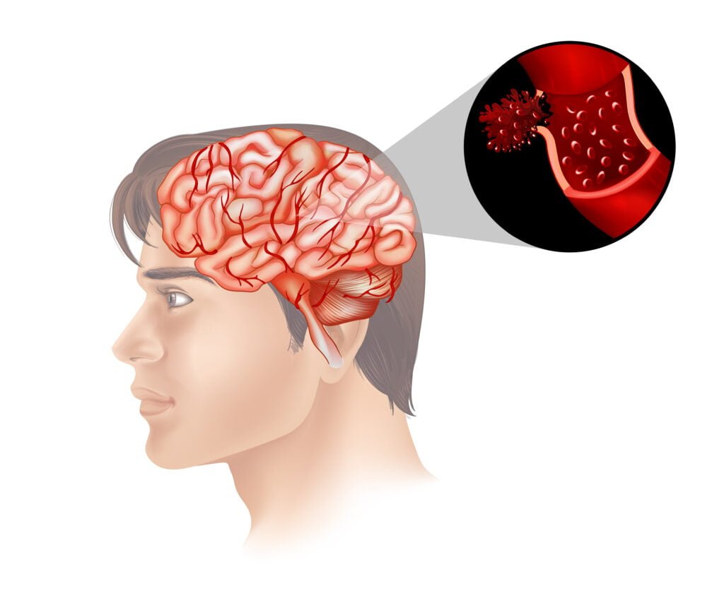 Nervous system