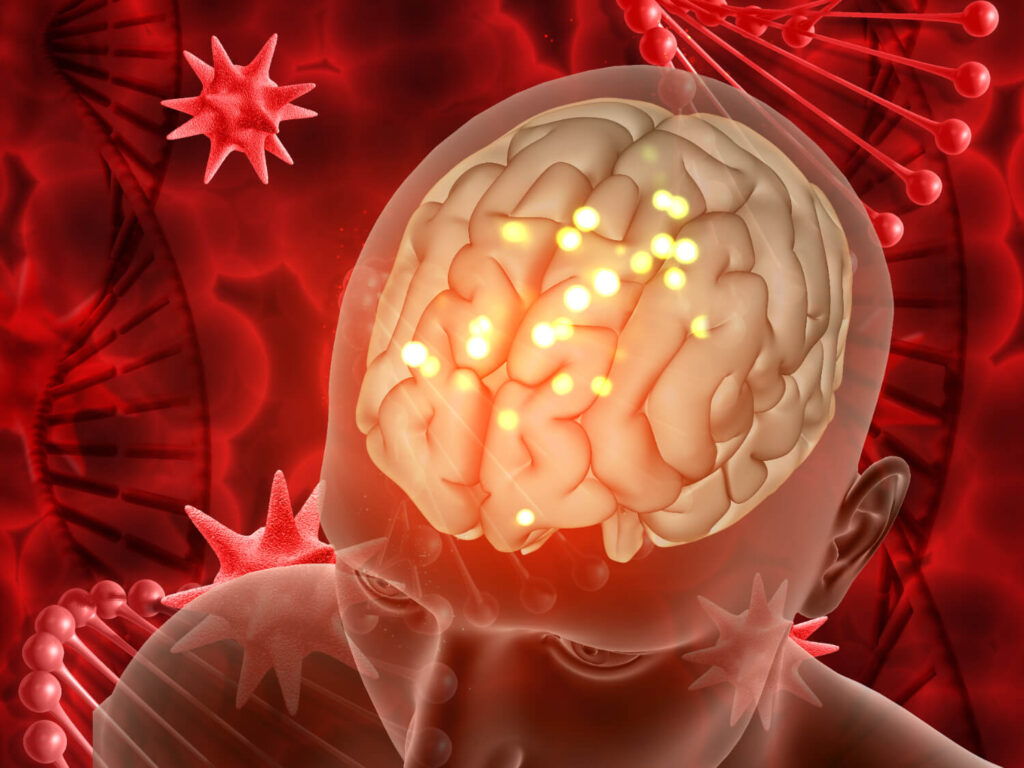 Symptoms and treatment of viral meningitis