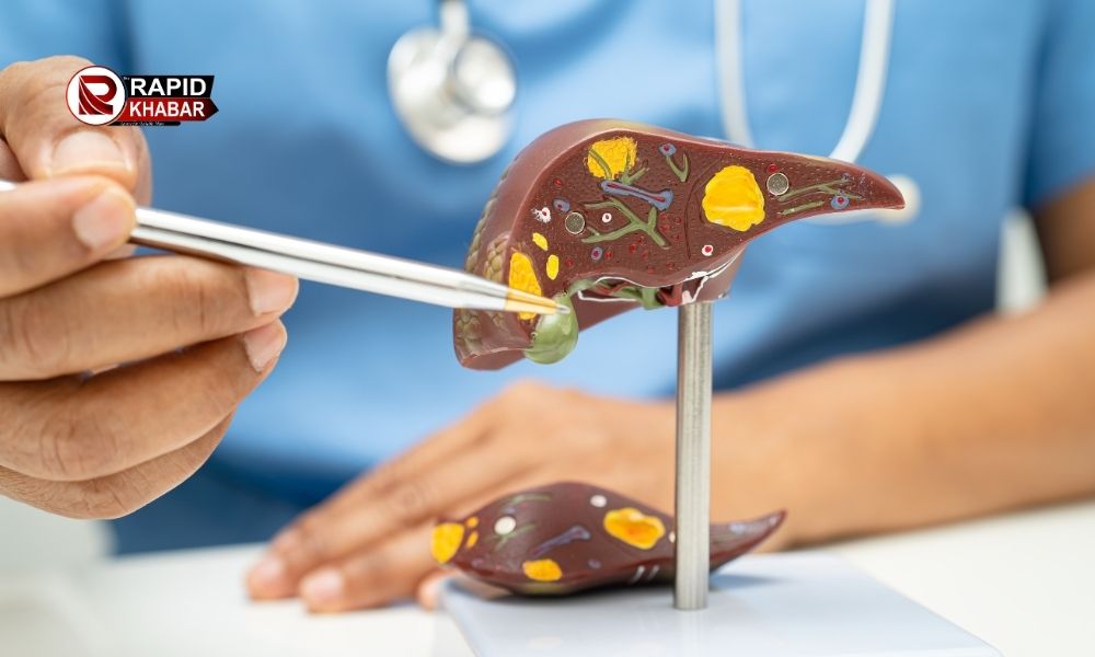 Liver Tumor Symptoms And Prevention