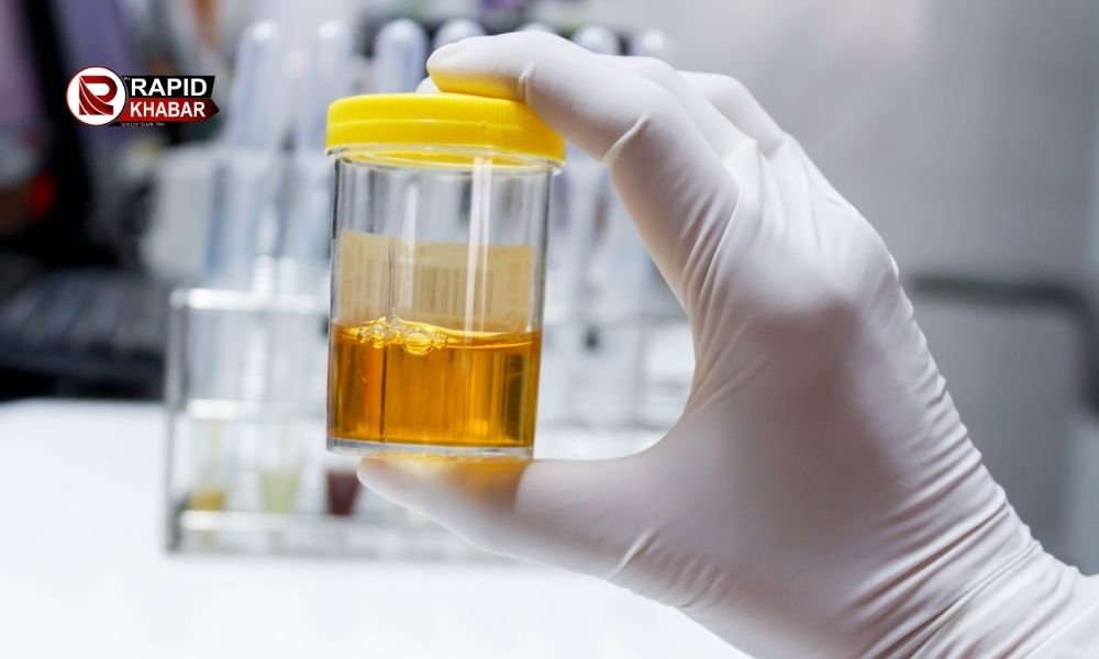Urine Color And Health Problems