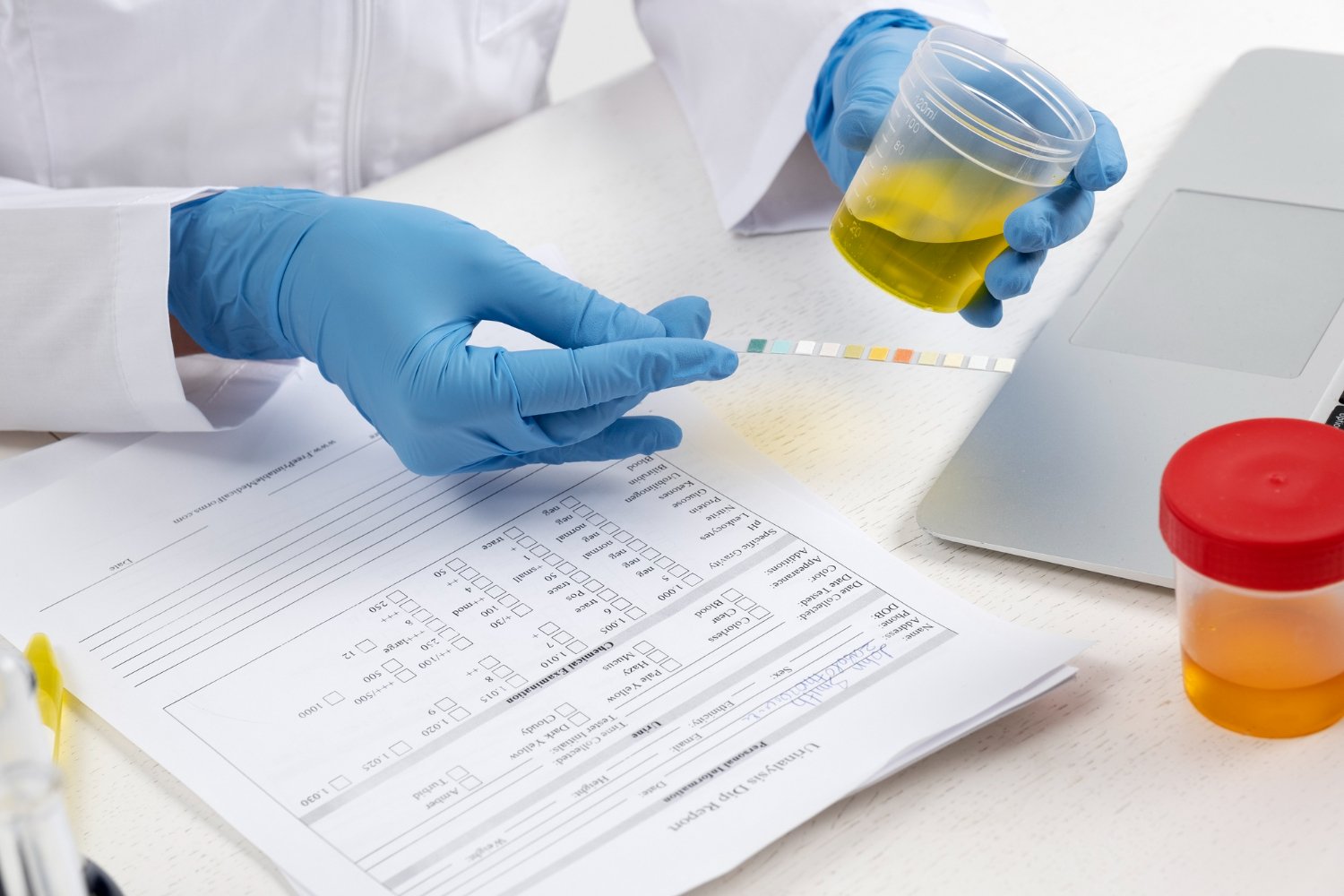 Urine color and health problems