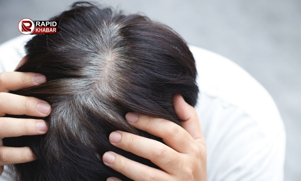 Tips To Stop Premature Greying