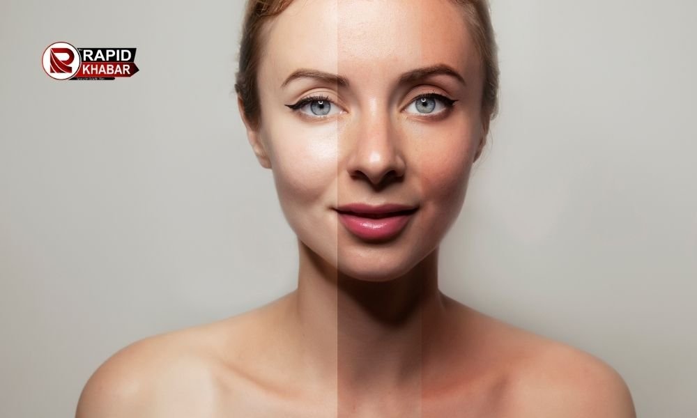 Tan Removal Homemade Face Packs